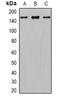 GLI Family Zinc Finger 1 antibody, GTX17495, GeneTex, Western Blot image 