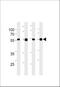 Transmembrane Phosphoinositide 3-Phosphatase And Tensin Homolog 2 antibody, M09798, Boster Biological Technology, Western Blot image 