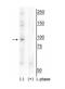 RB Binding Protein 8, Endonuclease antibody, NBP2-60770, Novus Biologicals, Western Blot image 