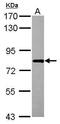 RNA Binding Motif Protein 14 antibody, GTX112293, GeneTex, Western Blot image 