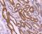 BCL2 Related Protein A1 antibody, A03850-2, Boster Biological Technology, Immunohistochemistry paraffin image 