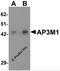 Adaptor Related Protein Complex 3 Subunit Mu 1 antibody, 6393, ProSci, Western Blot image 