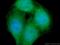 Nuclear Factor Kappa B Subunit 1 antibody, 14220-1-AP, Proteintech Group, Immunofluorescence image 