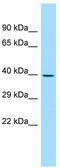 Protein NDRG3 antibody, TA337997, Origene, Western Blot image 