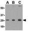 TP53 Induced Glycolysis Regulatory Phosphatase antibody, GTX31307, GeneTex, Western Blot image 