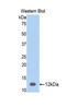 Serpin Family A Member 12 antibody, LS-C296984, Lifespan Biosciences, Western Blot image 