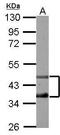 Transcription Factor Dp-2 antibody, GTX102365, GeneTex, Western Blot image 