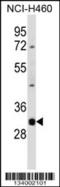 Deoxyribonuclease gamma antibody, 57-331, ProSci, Western Blot image 