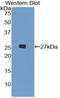 Leukocyte Immunoglobulin Like Receptor A3 antibody, LS-C295150, Lifespan Biosciences, Western Blot image 