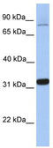 TIMELESS-interacting protein antibody, TA339728, Origene, Western Blot image 