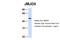 Jumonji domain-containing protein 5 antibody, 27-137, ProSci, Western Blot image 