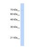 G2/M-Phase Specific E3 Ubiquitin Protein Ligase antibody, NBP1-55281, Novus Biologicals, Western Blot image 