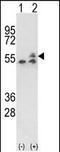 ATP Synthase F1 Subunit Beta antibody, A32270-2, Boster Biological Technology, Western Blot image 