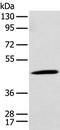 Kynurenine Aminotransferase 1 antibody, PA5-51313, Invitrogen Antibodies, Western Blot image 