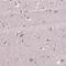 Carnitine Palmitoyltransferase 1C antibody, NBP2-68811, Novus Biologicals, Immunofluorescence image 