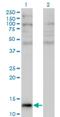 Angiogenin antibody, H00000283-M05, Novus Biologicals, Western Blot image 