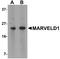 Putative MARVEL domain-containing protein 1 antibody, A13025, Boster Biological Technology, Western Blot image 