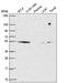 COP9 Signalosome Subunit 2 antibody, NBP2-58587, Novus Biologicals, Western Blot image 