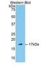 Serpin Family G Member 1 antibody, LS-C293469, Lifespan Biosciences, Western Blot image 