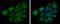 Enoyl-CoA hydratase, mitochondrial antibody, GTX114376, GeneTex, Immunocytochemistry image 
