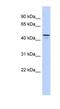 Ectonucleotide Pyrophosphatase/Phosphodiesterase 6 antibody, NBP1-57954, Novus Biologicals, Western Blot image 