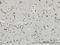 Ribosomal Protein S6 Kinase A2 antibody, H00006196-M01, Novus Biologicals, Immunohistochemistry paraffin image 