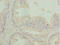 Ret Finger Protein Like 2 antibody, LS-C682137, Lifespan Biosciences, Immunohistochemistry paraffin image 