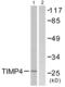 Metalloproteinase inhibitor 4 antibody, abx013234, Abbexa, Western Blot image 