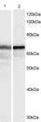 CLP1 antibody, PA5-18434, Invitrogen Antibodies, Western Blot image 