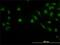 LIM Domain Binding 2 antibody, H00009079-M02, Novus Biologicals, Immunocytochemistry image 