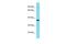 FYN Binding Protein 2 antibody, PA5-46346, Invitrogen Antibodies, Western Blot image 