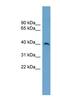 Suppressor Of Variegation 3-9 Homolog 2 antibody, NBP1-57056, Novus Biologicals, Western Blot image 