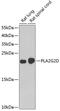 Phospholipase A2 Group IID antibody, 22-752, ProSci, Western Blot image 