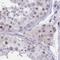 Retinoblastoma-like protein 1 antibody, NBP2-33735, Novus Biologicals, Immunohistochemistry paraffin image 