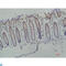 Galectin 3 antibody, LS-C812349, Lifespan Biosciences, Immunohistochemistry paraffin image 