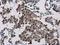 TRNA Methyltransferase 2 Homolog A antibody, GTX131442, GeneTex, Immunohistochemistry paraffin image 
