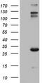 Immunoglobulin Superfamily Member 11 antibody, M09664, Boster Biological Technology, Western Blot image 