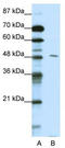 PBX Homeobox 2 antibody, TA335813, Origene, Western Blot image 