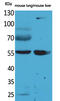 Aldehyde Dehydrogenase 1 Family Member A1 antibody, STJ96522, St John