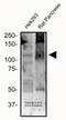 Calcium Sensing Receptor antibody, NB120-19347, Novus Biologicals, Western Blot image 