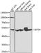 SET Domain Containing 6, Protein Lysine Methyltransferase antibody, GTX32868, GeneTex, Western Blot image 