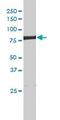 ERCC Excision Repair 2, TFIIH Core Complex Helicase Subunit antibody, ab54676, Abcam, Western Blot image 