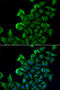 Fatty Acid Binding Protein 5 antibody, abx004873, Abbexa, Western Blot image 