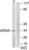 Granzyme K antibody, LS-C119554, Lifespan Biosciences, Western Blot image 