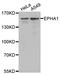 Ephrin type-A receptor 1 antibody, LS-C333951, Lifespan Biosciences, Western Blot image 