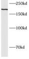 BCL6 Corepressor antibody, FNab00853, FineTest, Western Blot image 