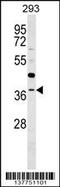 TRNA Methyltransferase 10B antibody, 59-626, ProSci, Western Blot image 