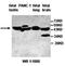 Acid Sensing Ion Channel Subunit 1 antibody, orb77726, Biorbyt, Western Blot image 