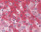 Fibroblast Growth Factor Receptor 4 antibody, 49-057, ProSci, Immunohistochemistry paraffin image 