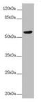 Serine/threonine-protein kinase receptor R3 antibody, orb41805, Biorbyt, Western Blot image 